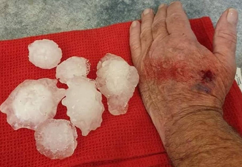 Avustralya'da Devasa Büyüklükte Dolu Yağdı!